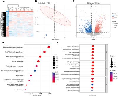 Endoplasmic reticulum stress-related features predict the prognosis of osteosarcoma and reveal STC2 as a novel risk indicator for disease progression